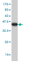 1 - GTF3C3 Antibody (monoclonal) (M01) AT2295a