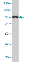 1 - GTF3C3 Antibody (monoclonal) (M01) AT2295a