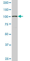 1 - GTF3C3 Antibody (monoclonal) (M01) AT2295a
