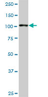 1 - GTF3C3 Antibody (monoclonal) (M01) AT2295a