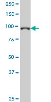 1 - GTF3C3 Antibody (monoclonal) (M02) AT2296a