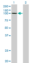 1 - GTF3C3 Antibody (monoclonal) (M02) AT2296a