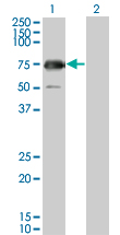 1 - GYG2 Antibody (monoclonal) (M04) AT2304a