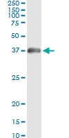 5 - HADHSC Antibody (monoclonal) (M01) AT2309a