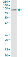 5 - HAL Antibody (monoclonal) (M04) AT2311a