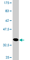 1 - HAPLN4 Antibody (monoclonal) (M12) AT2316a