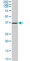 1 - HAPLN4 Antibody (monoclonal) (M12) AT2316a
