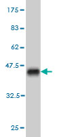 1 - HELZ Antibody (monoclonal) (M04) AT2349a