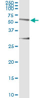 5 - HERPUD1 Antibody (monoclonal) (M04) AT2354a