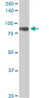 1 - HIC1 Antibody (monoclonal) (M01) AT2367a