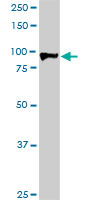 1 - HIC1 Antibody (monoclonal) (M02) AT2368a