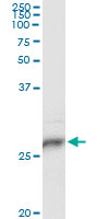 5 - HLA-DPB1 Antibody (monoclonal) (M01) AT2377a
