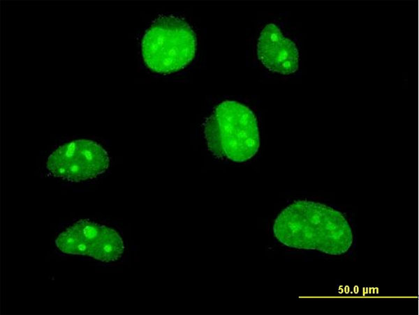 3 - HLF Antibody (monoclonal) (M01) AT2379a