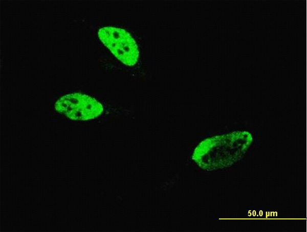 3 - HLF Antibody (monoclonal) (M04) AT2380a