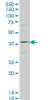 1 - HOXD11 Antibody (monoclonal) (M03) AT2426a