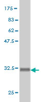 1 - HOXD9 Antibody (monoclonal) (M01) AT2431a