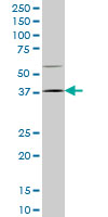 1 - HOXD9 Antibody (monoclonal) (M01) AT2431a