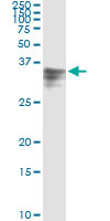 5 - HPX Antibody (monoclonal) (M01) AT2435a