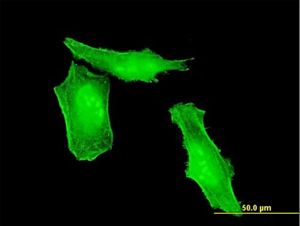 3 - HRSP12 Antibody (monoclonal) (M01) AT2437a