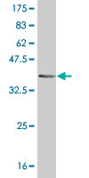 1 - HRSP12 Antibody (monoclonal) (M01) AT2437a