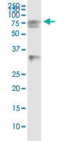 5 - HSPA2 Antibody (monoclonal) (M02) AT2447a