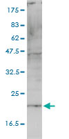 1 - HSPC163 Antibody (monoclonal) (M01) AT2453a