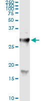 5 - HYAL1 Antibody (monoclonal) (M01) AT2461a