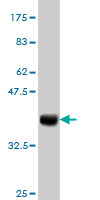 1 - IBRDC1 Antibody (monoclonal) (M01) AT2465a