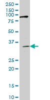 1 - IBRDC1 Antibody (monoclonal) (M01) AT2465a