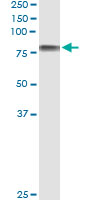 5 - ICAM1 Antibody (monoclonal) (M01) AT2468a
