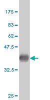 1 - IFNE1 Antibody (monoclonal) (M01) AT2489a