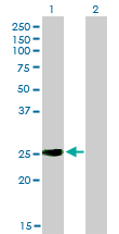 1 - IGSF6 Antibody (monoclonal) (M01) AT2495a