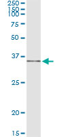 5 - IL1B Antibody (monoclonal) (M01) AT2509a