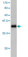 1 - IL1F9 Antibody (monoclonal) (M01) AT2511a