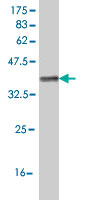1 - IL1RAPL1 Antibody (monoclonal) (M04) AT2512a
