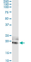 5 - IL20 Antibody (monoclonal) (M01) AT2514a