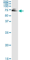 5 - IMPDH2 Antibody (monoclonal) (M01) AT2530a