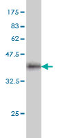 1 - IQGAP2 Antibody (monoclonal) (M01) AT2536a