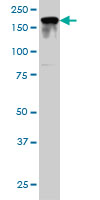 1 - IQGAP2 Antibody (monoclonal) (M01) AT2536a