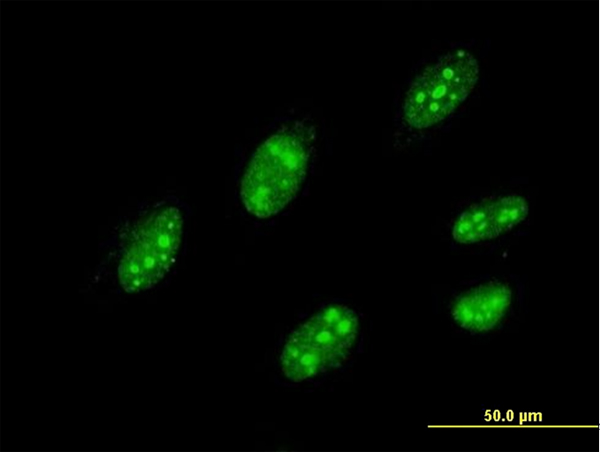 3 - IQGAP3 Antibody (monoclonal) (M01) AT2537a