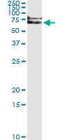 5 - IRAK1 Antibody (monoclonal) (M01) AT2538a