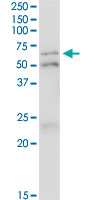 5 - IRF5 Antibody (monoclonal) (M03) AT2547a