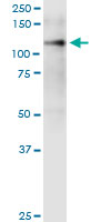1 - ITGA9 Antibody (monoclonal) (M01) AT2567a