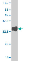 1 - ITPKB Antibody (monoclonal) (M01) AT2574a
