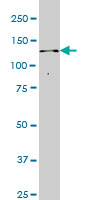 1 - ITPKB Antibody (monoclonal) (M01) AT2574a