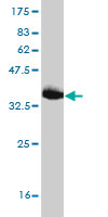 1 - JPH1 Antibody (monoclonal) (M04) AT2584a