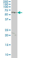 1 - JRKL Antibody (monoclonal) (M01) AT2585a