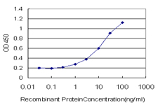 10 - JTB Antibody (monoclonal) (M02) AT2586a