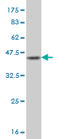 1 - JTB Antibody (monoclonal) (M02) AT2586a