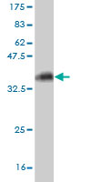 1 - KCNMB3 Antibody (monoclonal) (M02) AT2601a